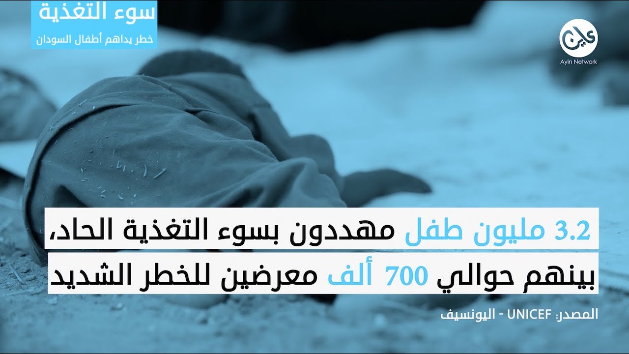 سوء التغذية.. خطر يداهم أطفال السودان
