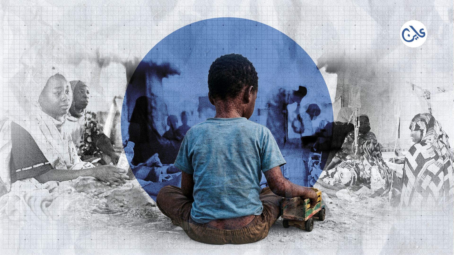 تفشي مرض الحصبة